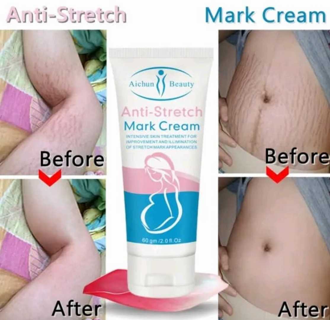 Anti-Stretch Mark Mother Cream